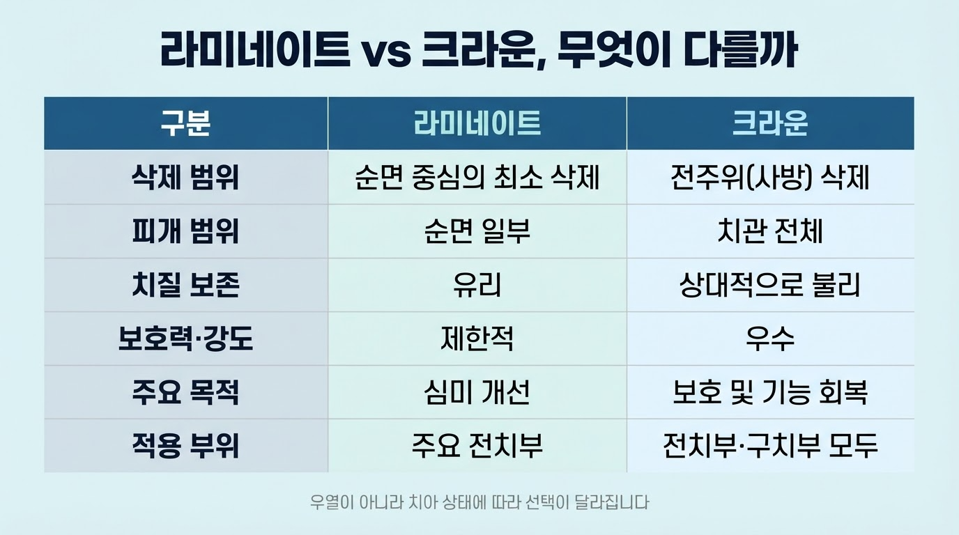 라미네이트와 크라운의 차이