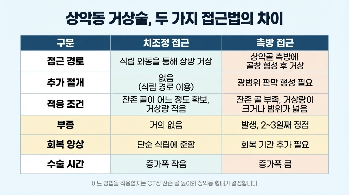 상악동 거상술 — 위 어금니 임플란트가 어려운 이유