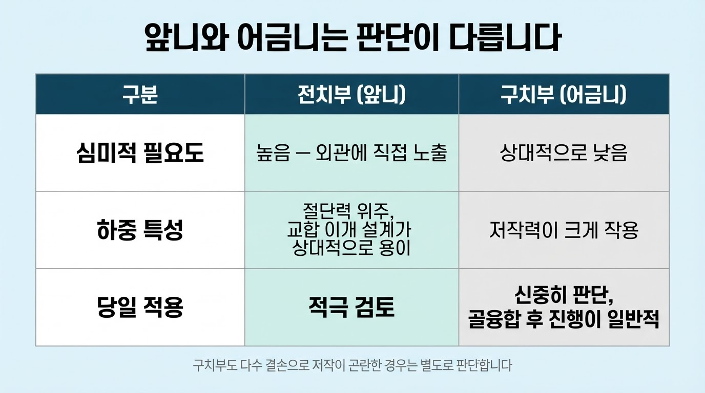 앞니와 어금니 임시치아의 차이