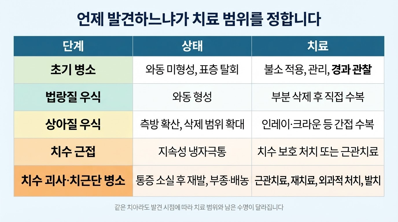 충치 진행 단계 — 아프지 않은 이유와 치료 범위