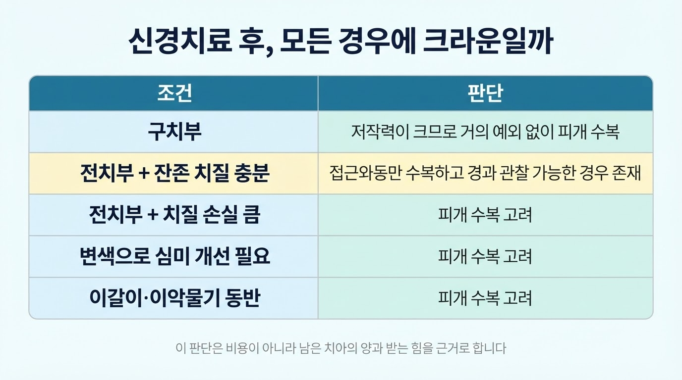 신경치료 후 크라운이 필요한 이유 — 파절과 밀봉