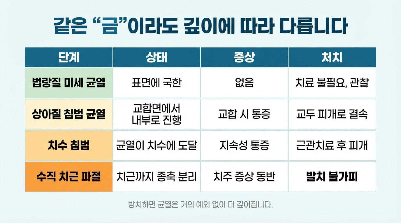 치아 균열의 양상에 따른 치료방법