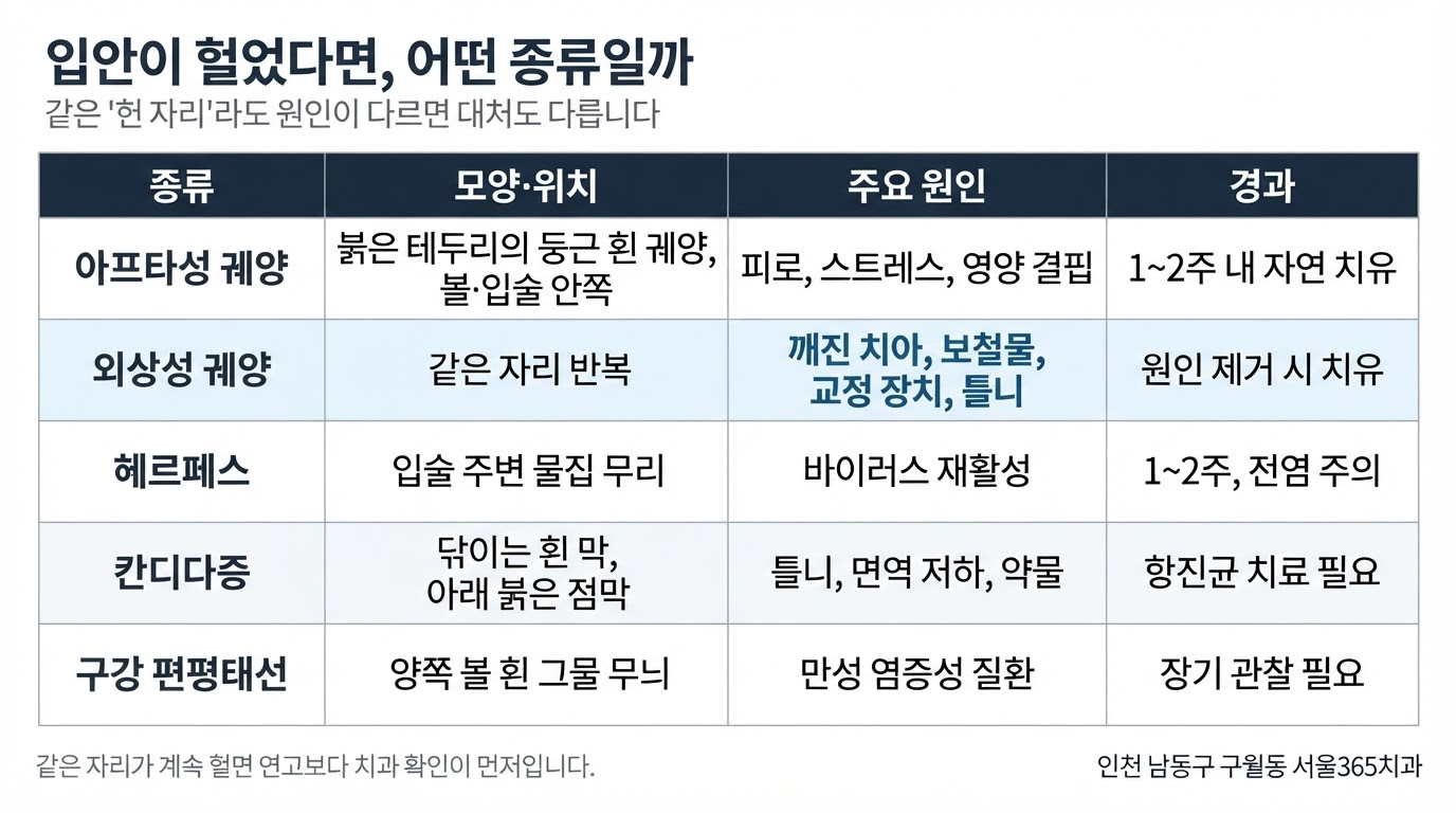 구내염 종류와 원인 — 2주 넘으면 확인해야 하는 이유