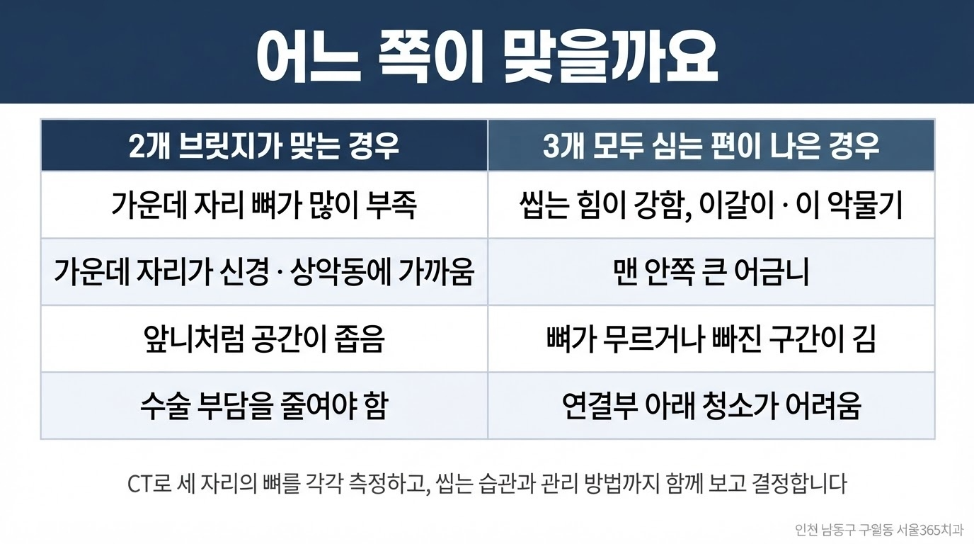 임플란트 브릿지 — 빠진 이 3개, 임플란트 3개를 꼭 심어야 할까